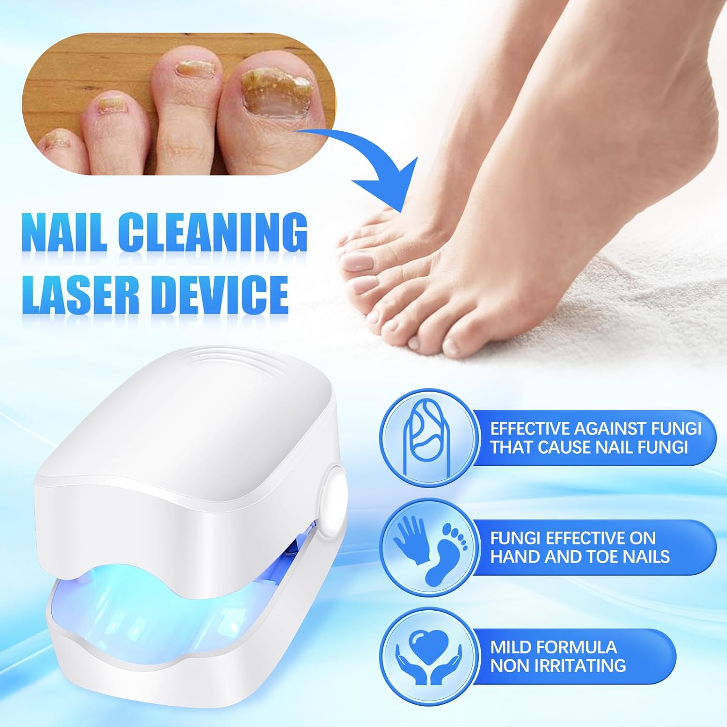 Rechargeable Nail Fungus Treatment for Toenail, Toe Nail Fungal Treatment Nail Fungus Laser Device, Anti-Fungal Nail Treatment for Hand & Feet Infections Remover for Home Use - Bhavnagar Deodap