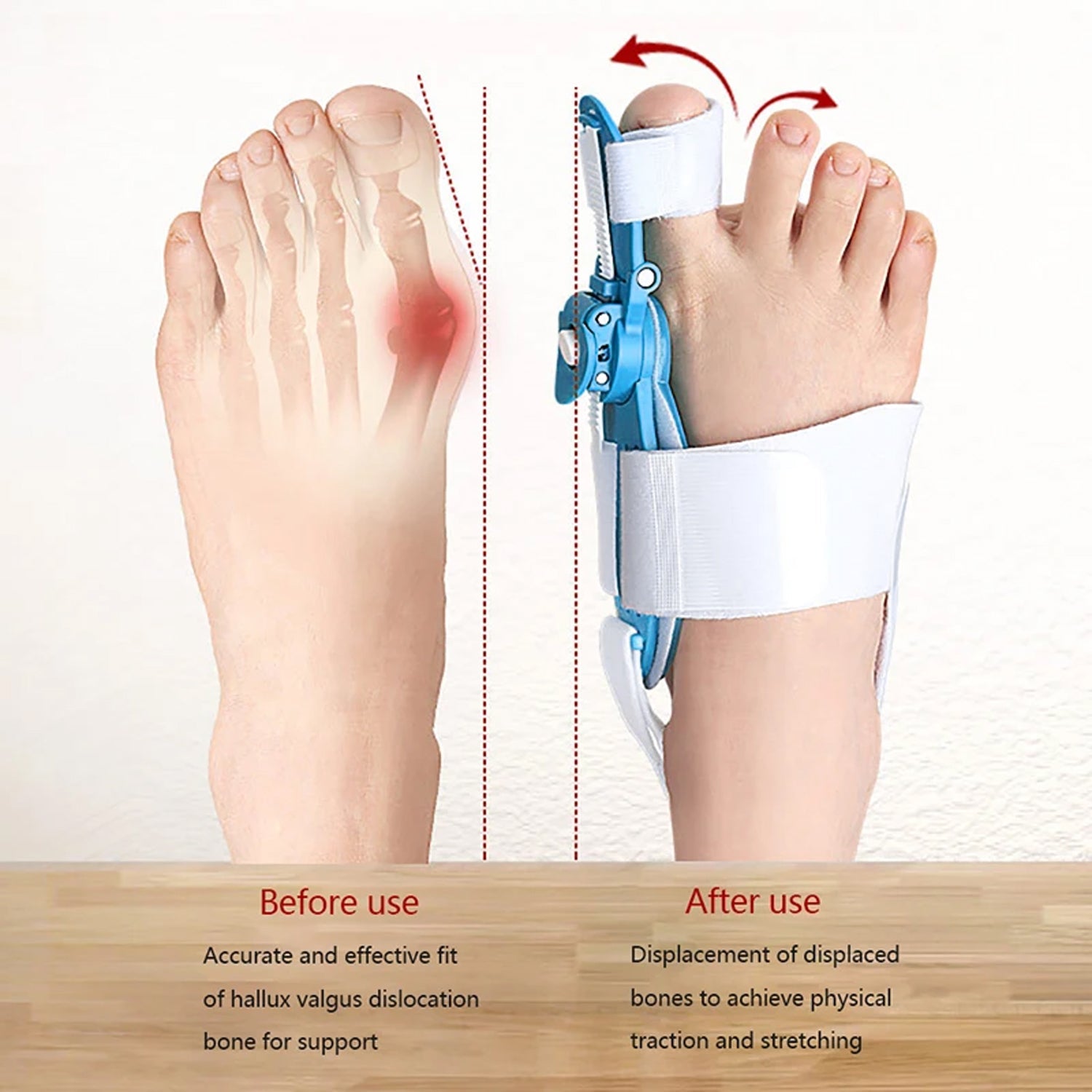 Bunion Support Splint. Valgus And Bunion Valgus, Corrector, Hallux Valgus Corrector, Adjustable Bunion Valgus Protective Cover For Men And Women - Bhavnagar Deodap