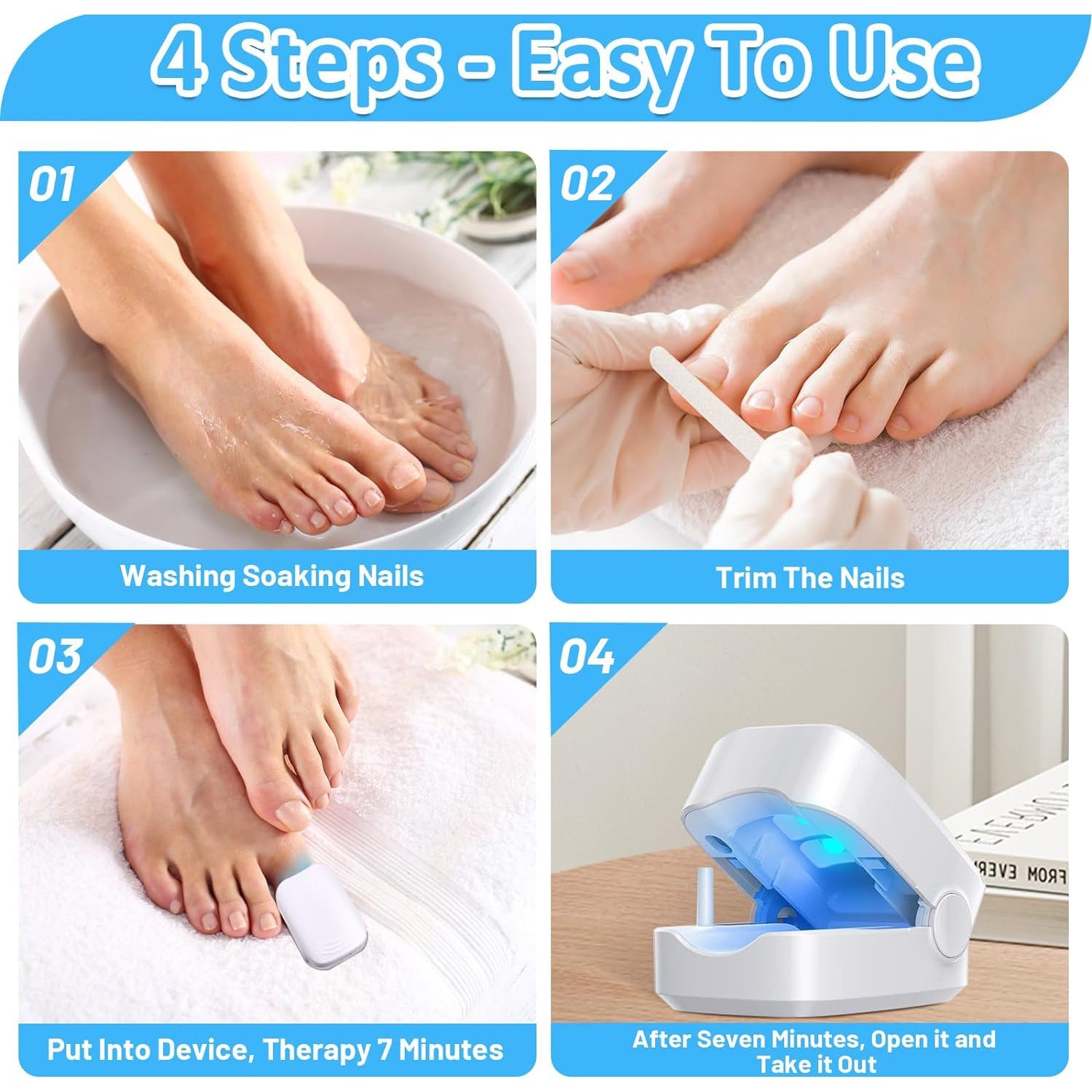 Rechargeable Nail Fungus Treatment for Toenail, Toe Nail Fungal Treatment Nail Fungus Laser Device, Anti-Fungal Nail Treatment for Hand & Feet Infections Remover for Home Use - Bhavnagar Deodap