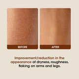 Body Lotion for Winter 